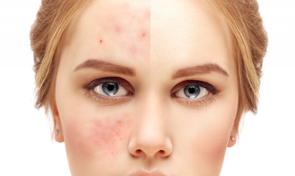skin health
